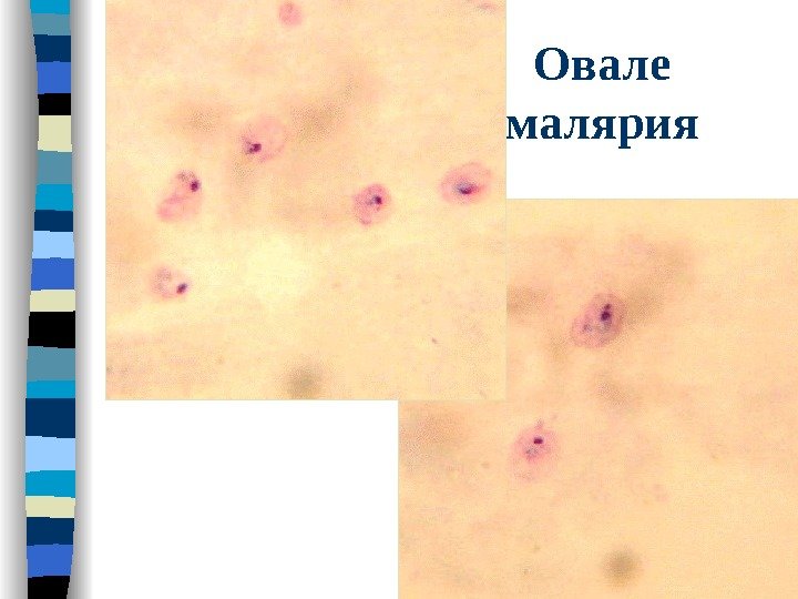 Овале малярия 